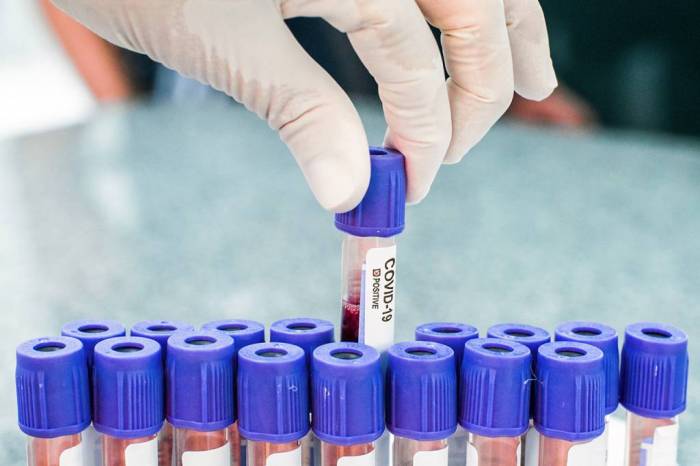 Município confirma 155 novos casos de coronavírus