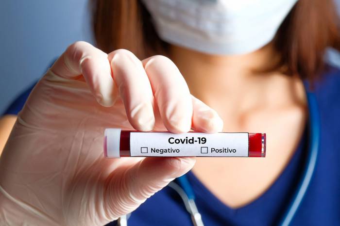 Boletim Coronavírus nº 448 – 09/06/2021