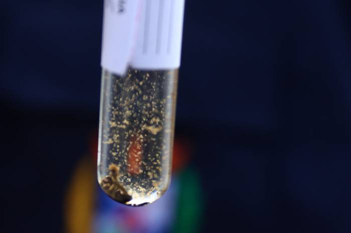 Seguem estáveis os registros de dengue no município
