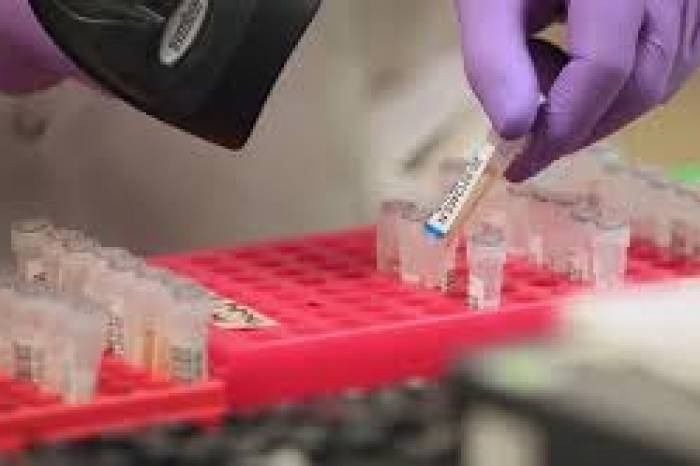 Somente a Vigilância Epidemiológica registrou 36.139 exames realizados desde o início da pandemia