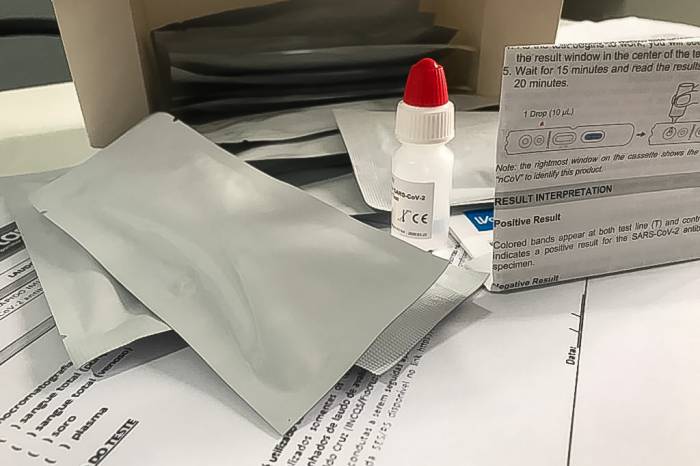 Procedimentos incluem os efetivados pelo Lacen e pelos laboratórios privados, além dos testes de pesquisa da UFPel sobre o contágio do Sars-CoV-2