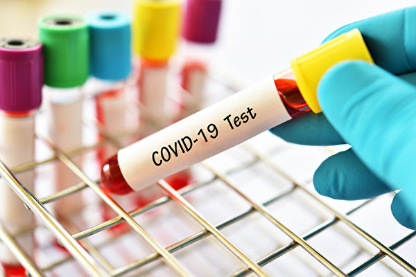 Pelotas tem mais 337 casos confirmados de coronavírus