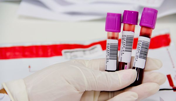 Município registra mais quatro óbitos causados pela Covid-19