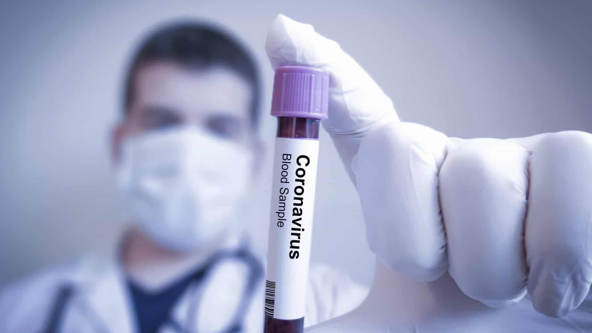 Pelotas registra 363 casos positivos de Covid-19