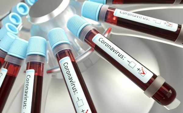 Município registra 147 pessoas contaminadas pelo novo coronavírus