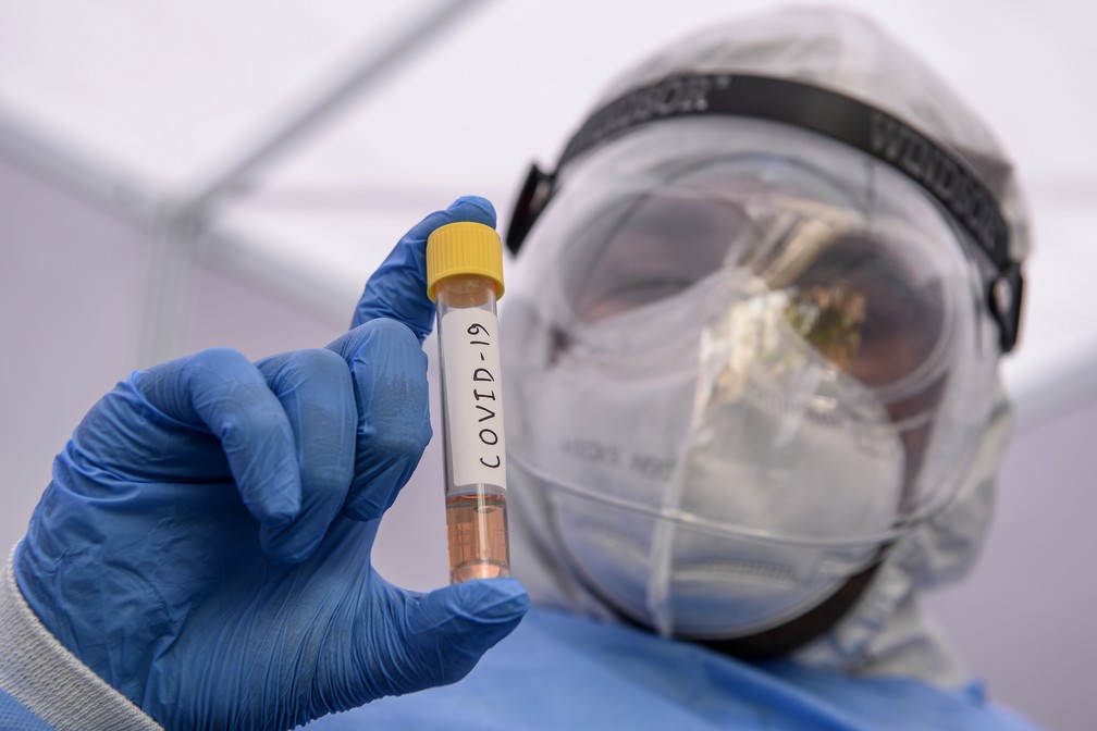 A partir de terça-feira (21), pontos serão instalados em locais de grande circulação do município, para facilitar o acesso ao diagnóstico por meio de testes rápidos de Antígeno (TR-Ag)