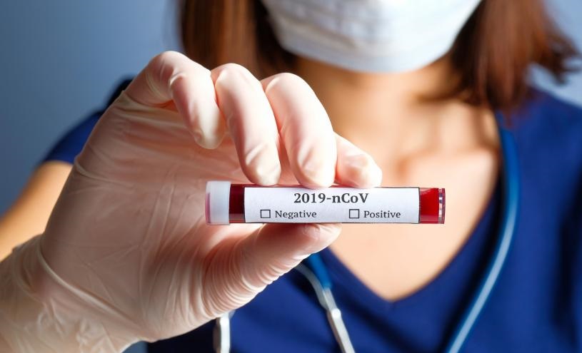 Vigilância Epidemiológica contabiliza testes rápidos no monitoramento de casos positivos para Covid-19 em Pelotas