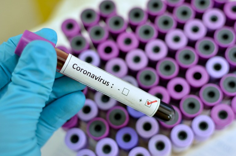 Pelotas registra mais nove mortes causadas pelo novo coronavírus