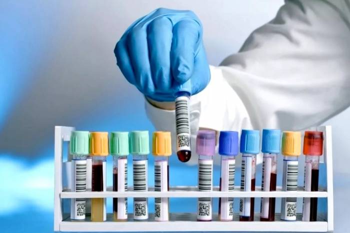 Pelotas tem 64 casos confirmados de Covid-19