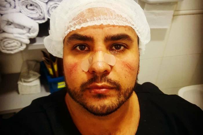 Jornalista e servidor público da Prefeitura, Rafaél de Lima, que se voluntariou para trabalhar no Centro Covid — unidade de saúde que começou operar há um mês —, relata a rotina dos plantões, os momentos de tensão e a saudade da família