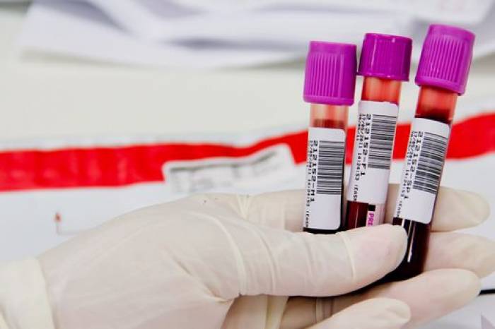 Município registra mais quatro óbitos causados pela Covid-19