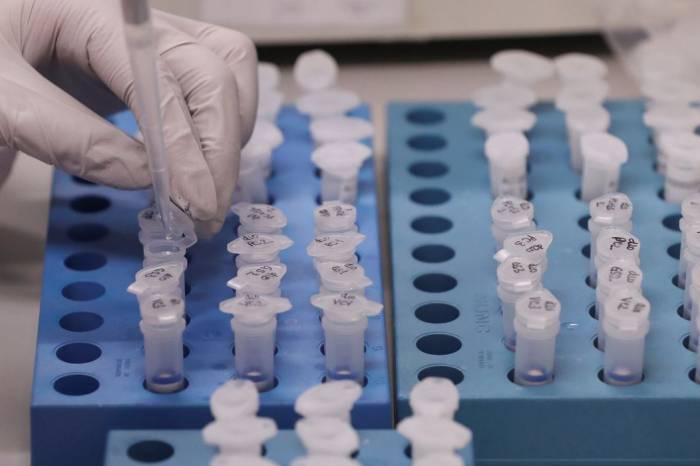 Município registra mais três óbitos pela Covid-19