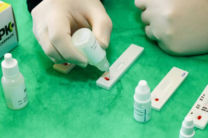 Pelotas contabiliza 165 casos de Covid-19