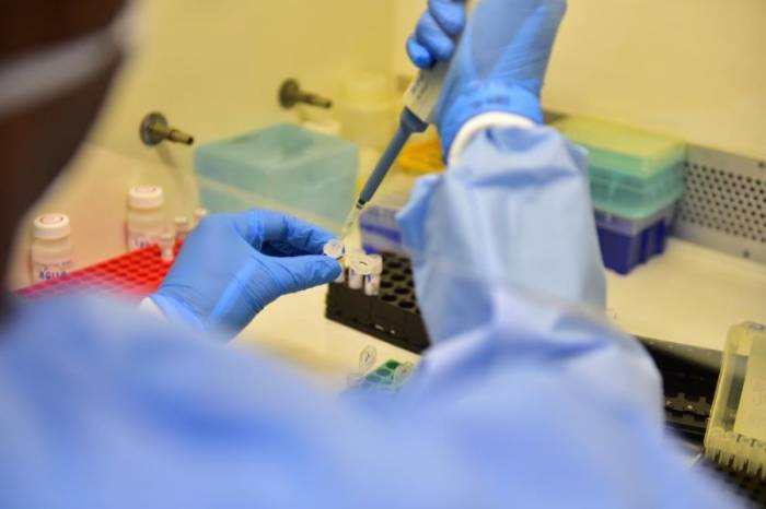 Epidemiologia reclassificou mais quatro óbitos provocados pela Covid-19 em Pelotas