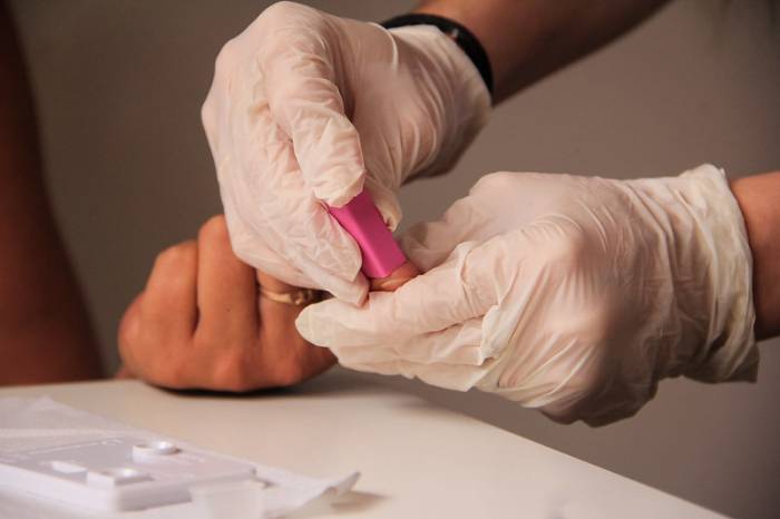Serviço estará disponível no dia 21, das 13 às 17h no Cras São Gonçalo. Ação busca enfatizar a importância do diagnóstico precoce e do tratamento adequado da Sífilis, especialmente em gestantes