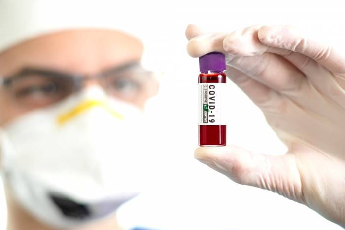 Pesquisa da UFPel registra mais um teste positivo para o novo coronavírus