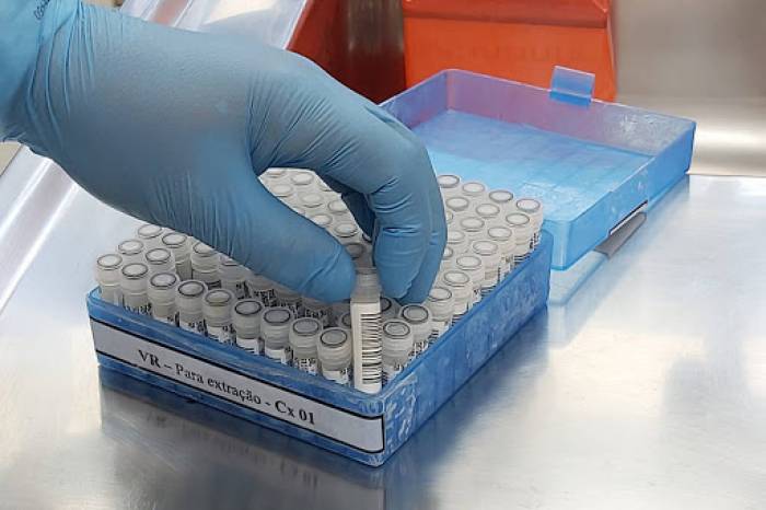 Pelotas tem mais 26 casos confirmados de coronavírus