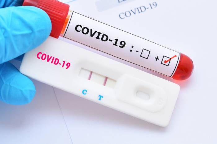 Município ultrapassa 44 mil exames para detectar a infecção pelo vírus causador da Covid-19
