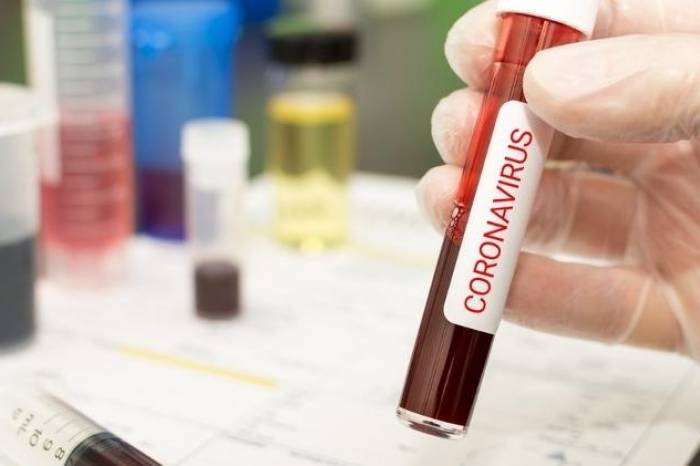 Pelotas registra mais 122 casos positivos de coronavírus