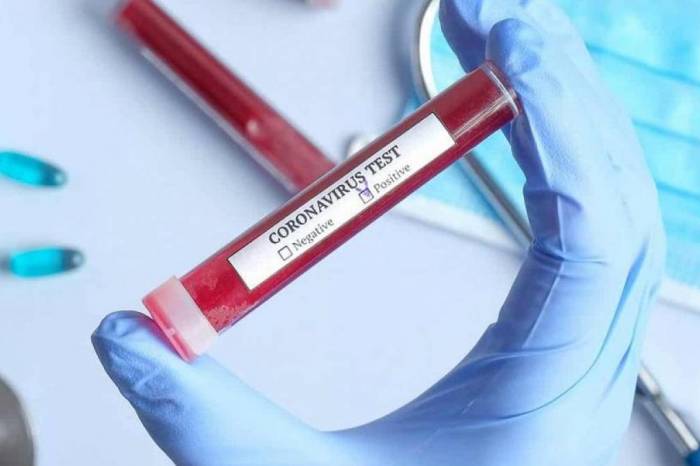 Pelotas registra 16 novos casos de  pessoas infectadas com o novo coronavírus