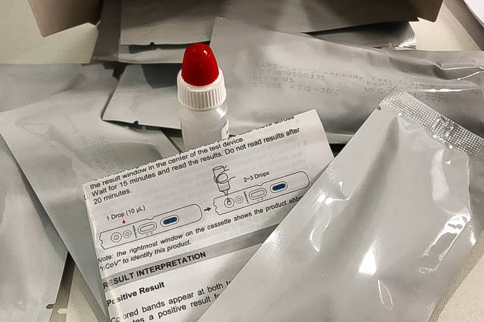 Seis novos casos de Covid-19  são confirmados em Pelotas