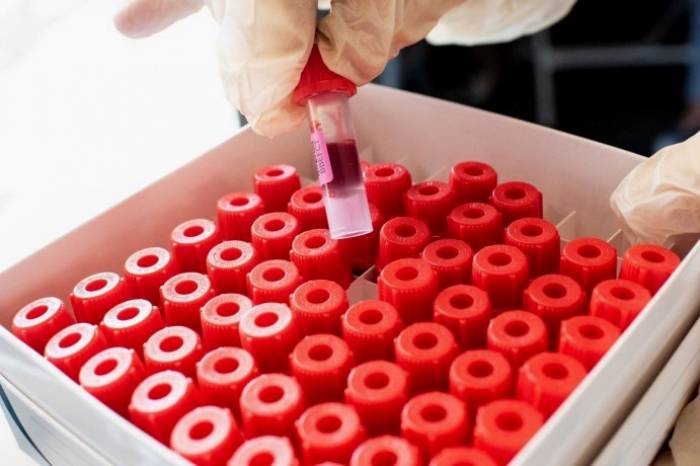 Município registra 100 novos casos neste domingo
