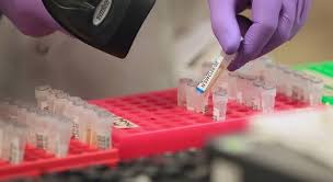 Somente a Vigilância Epidemiológica registrou 36.139 exames realizados desde o início da pandemia