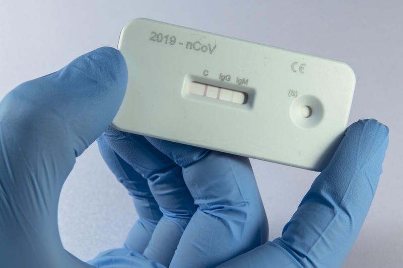 Pelotas registra mais quatro casos positivos para infecção pelo vírus Sars-COV-2