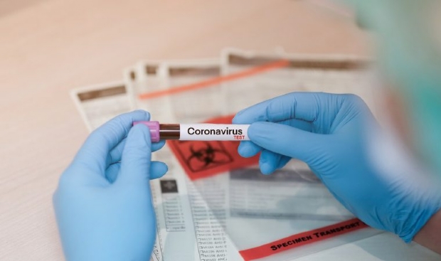 Em uma semana, Pelotas registrou 1.722 novos testes para confirmar ou descartar infecção pelo novo coronavírus