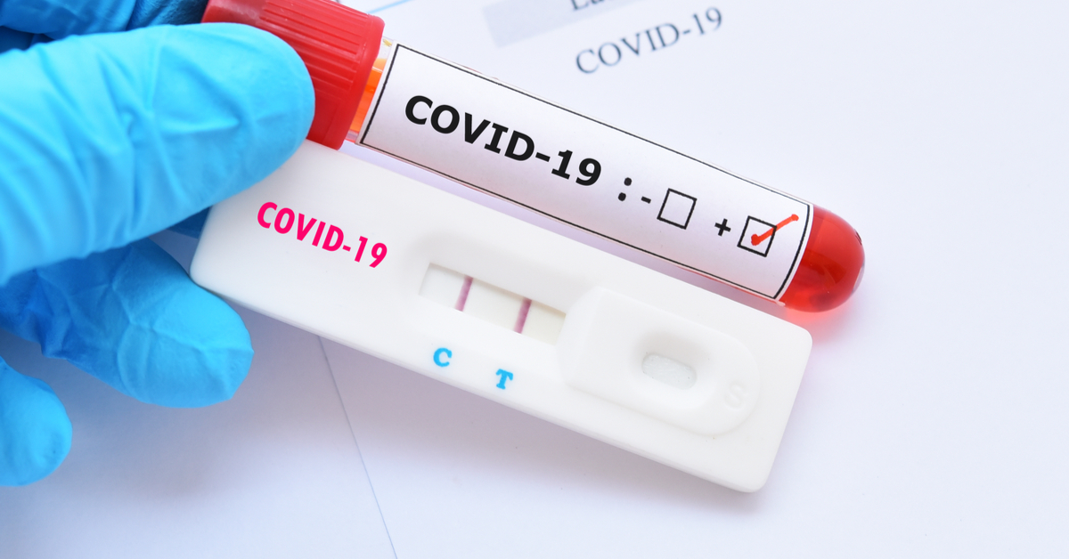 Município ultrapassa 44 mil exames para detectar a infecção pelo vírus causador da Covid-19