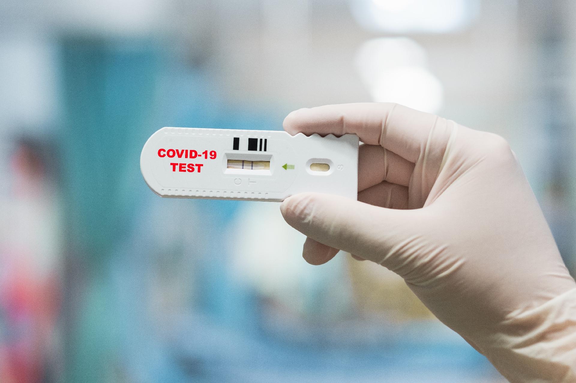 Município registra 72 novos casos de Covid-19
