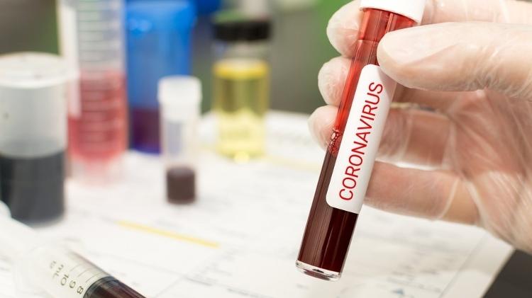 Pelotas alcança os 170 casos positivos para infecção pelo novo coronavírus